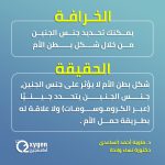 أول وفاة بإنفلونزا الطيور في أمريكا تسجلها ولاية لويزيانا