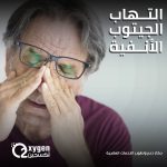 مكملات فيتامين “د” قد تخفض ضغط الدم لدى كبار السن المصابين بالسمنة
